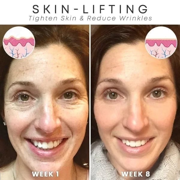 Last Day Promotion 49% OFF - š„Botox Face Serum