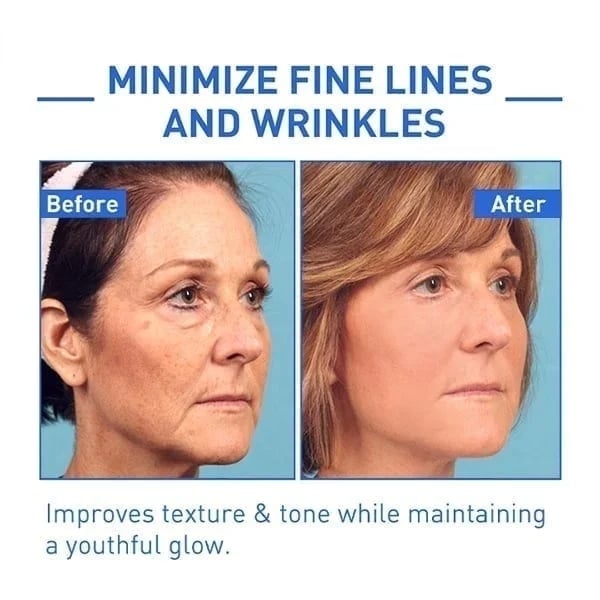 Last Day Promotion 49% OFF - š„Botox Face Serum