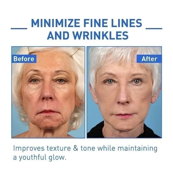 Last Day Promotion 49% OFF - š„Botox Face Serum