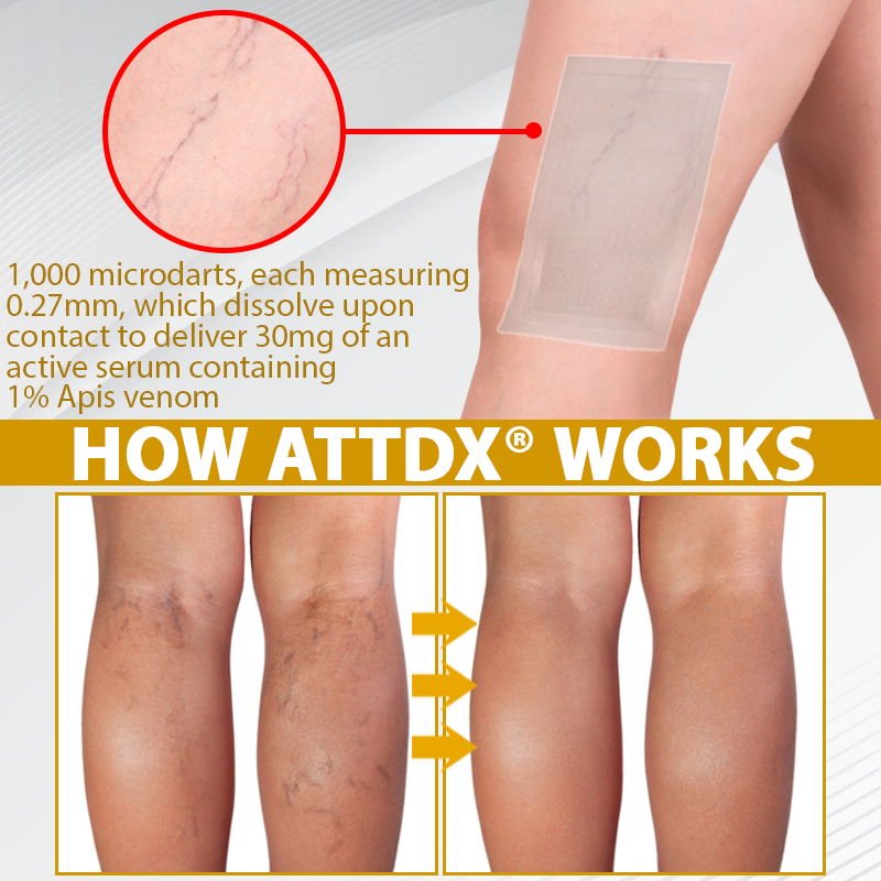 ODEIUN® MicroSting Bee Vein Ease Patches