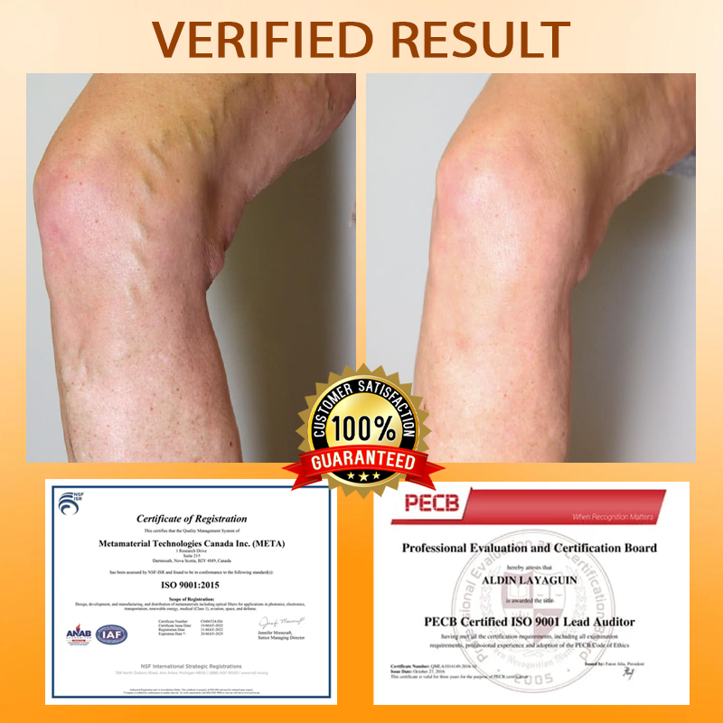 ODEIUN® MicroSting Bee Vein Ease Patches