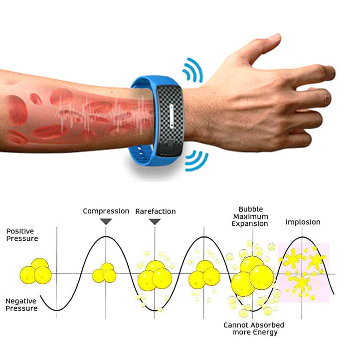 (š„LAST DAY 70% OFF) Seurico⢠Matteo Ultrasonic Body Shape Wristband Pro š„