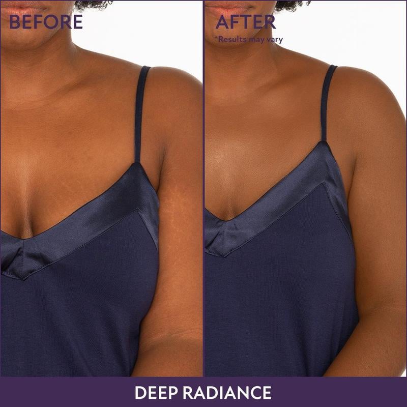 Body Coverage Perfector – All-in-one moisturizer, concealer & coverage 💧✨ Lightweight & waterproof