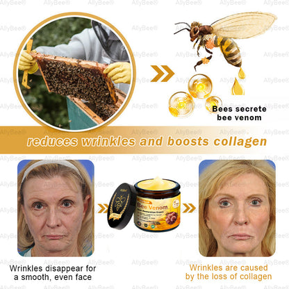 【Official Shop】 AllyBee® Skin Treatment Cream Anti-aging, Hydrating, Skin Repair, Even Tone, Acne and Dark Spot Treatment, Wart and Mole Removal, Psoriasis Relief