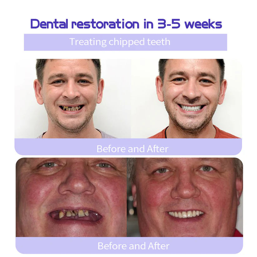 Magic Whitening Toothpaste JEREMYTIS™  Powder with Hydroxyapatite - World's First & Only! Sprinkle or Dip!