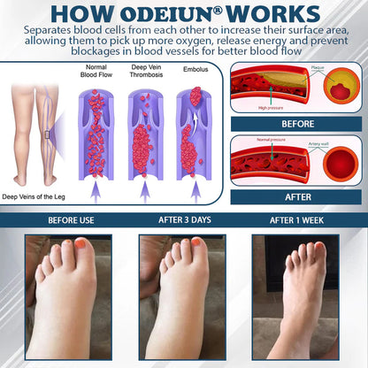 ODEIUN® Black Cumin Edema Detox Herbal Cream