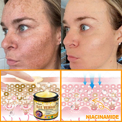 🔥 ODEIUN® 𝖡𝖾𝖾 𝗏𝖾𝗇𝗈𝗆 𝖲𝗄𝗂𝗇 𝖱𝖾𝗌𝗍𝗈𝗋𝖺𝗍𝗂𝗈𝗇 𝖢𝗋𝖾𝖺𝗆✨Made and Shipped from USA