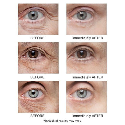 🔥Last Day 49% OFF🔥 Instant Eye Lift Firming Cream💕