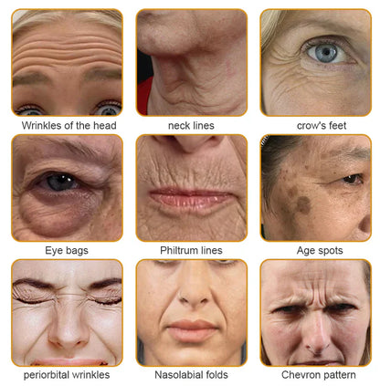 【Official Shop】 AllyBee® Skin Treatment Cream Anti-aging, Hydrating, Skin Repair, Even Tone, Acne and Dark Spot Treatment, Wart and Mole Removal, Psoriasis Relief