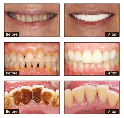 ⏰[Official Brand Store 24-Hours Promotion]" JEREMYTIS Ultra Whitening Mint Toothpaste✨"