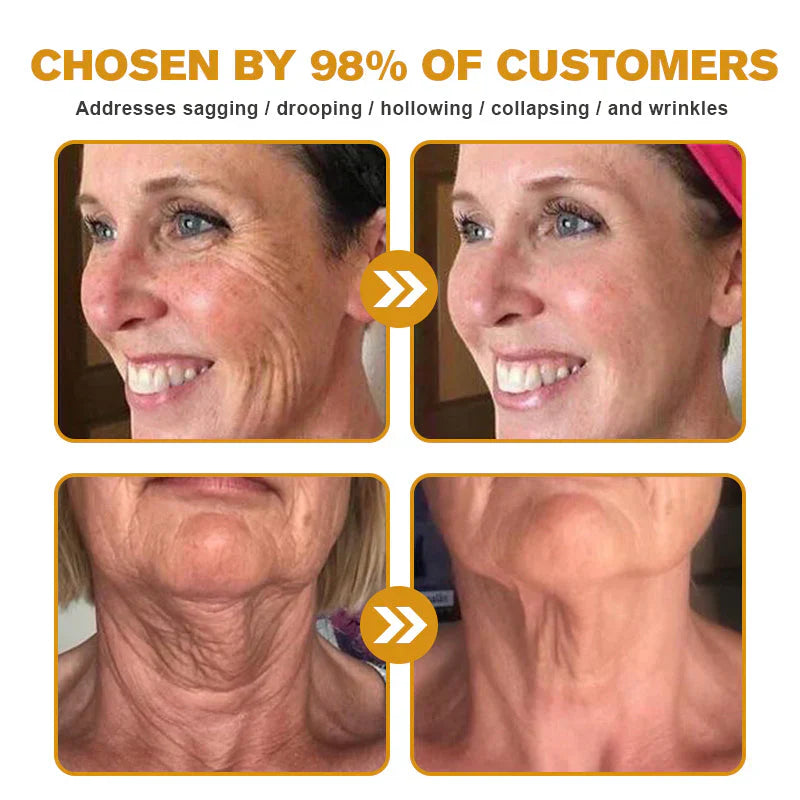 【Official Shop】 AllyBee® Skin Treatment Cream Anti-aging, Hydrating, Skin Repair, Even Tone, Acne and Dark Spot Treatment, Wart and Mole Removal, Psoriasis Relief