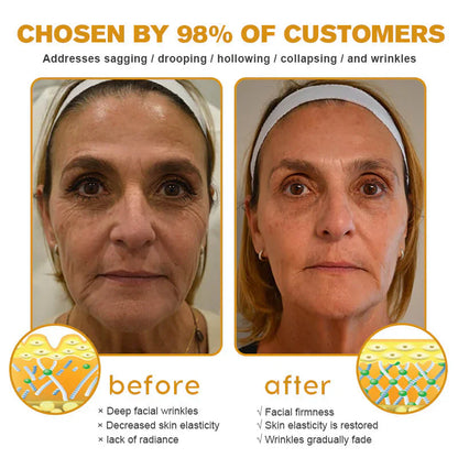 【Official Shop】 AllyBee® Skin Treatment Cream Anti-aging, Hydrating, Skin Repair, Even Tone, Acne and Dark Spot Treatment, Wart and Mole Removal, Psoriasis Relief